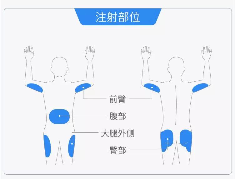 胰岛素,你用对了吗?